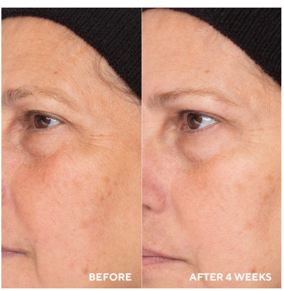Retinol routine booster